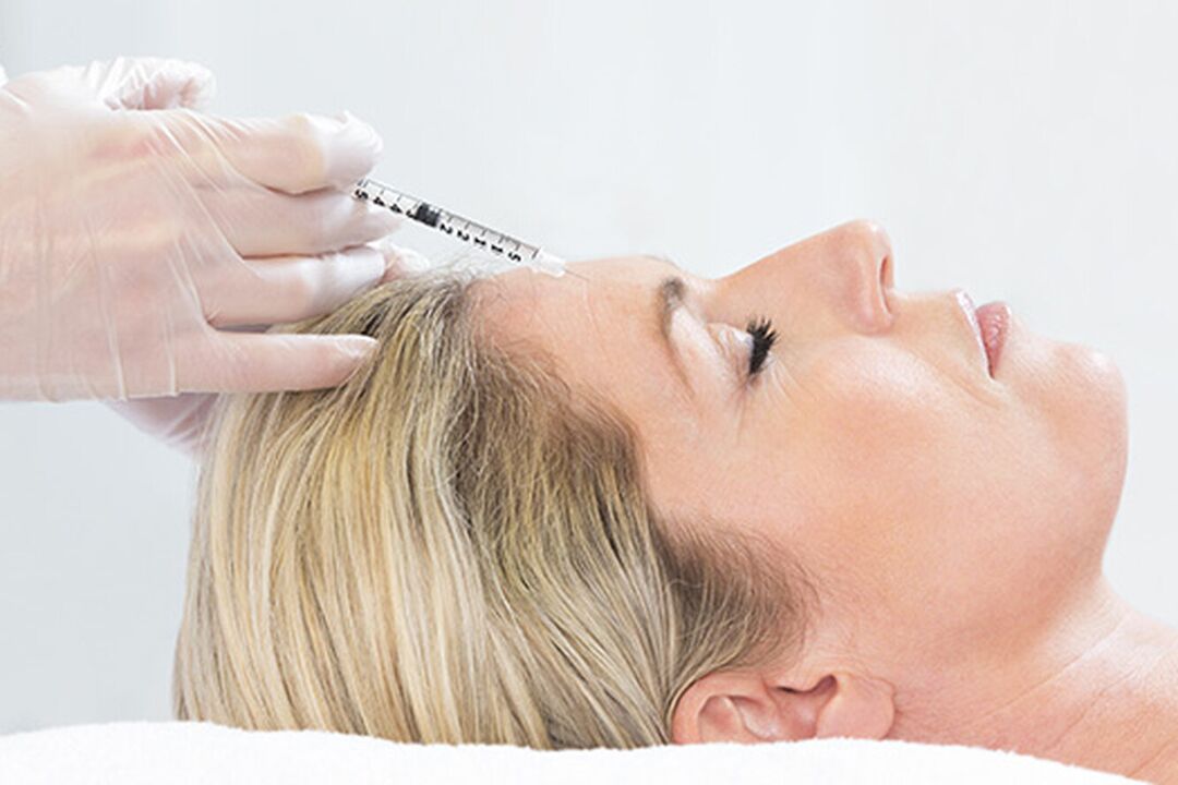 Плазмолифтинг – инъекционный метод омоложения кожи лица